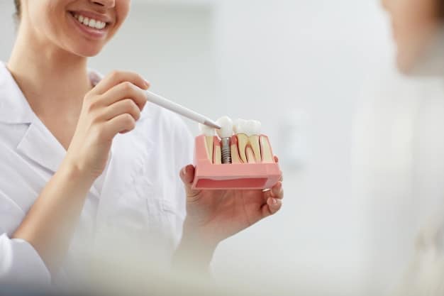 Featured image for “10 Reasons To Get Dental Implants”
