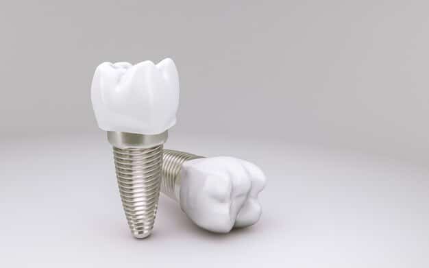 Featured image for “Dental Implants: Reasons To Say Yes”