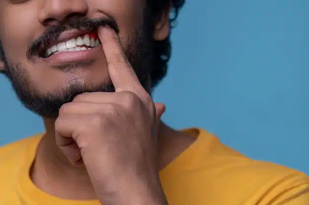 Featured image for “Gum Disease – Symptoms & Treatments”