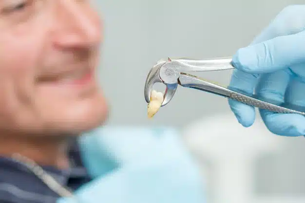 Featured image for “Everything About Tooth Extraction”