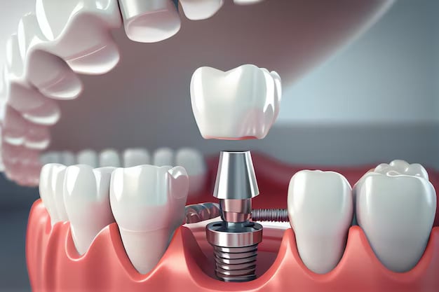 Featured image for “What To Expect During A Dental Implant Procedure: Step By Step”