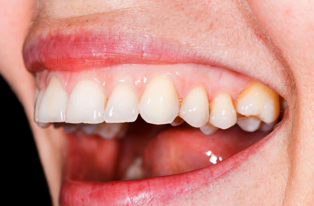 Featured image for “ The Role of Nutrition in Periodontal Health: Foods That Support Your Gums”