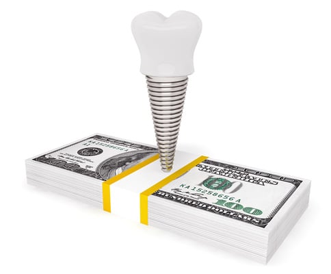 the cost of dental implants
