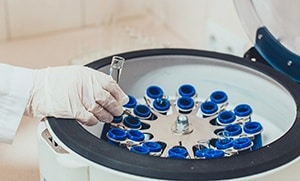 the image of prpprf treatment