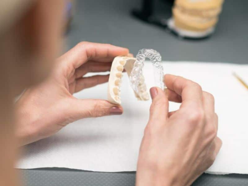 cost of invisalign-exceptional dentistry chandler