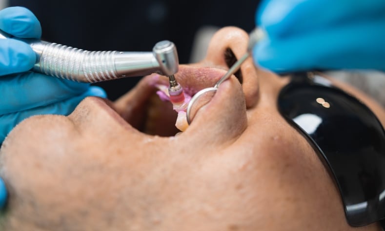 Featured image for “Early Signs of Gum Disease and Why You Shouldn’t Ignore Them”